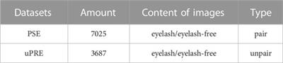 Joint conditional generative adversarial networks for eyelash artifact removal in ultra-wide-field fundus images